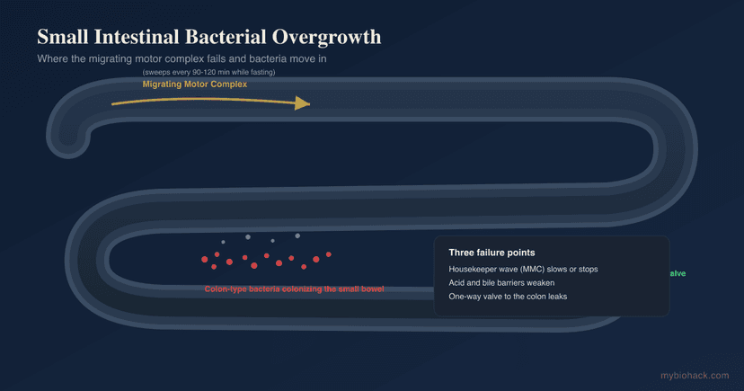 SIBO (Small Intestinal Bacterial Overgrowth): Root Causes, Testing, And Evidence-Based Treatment