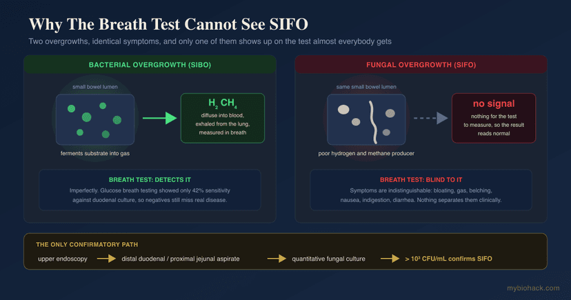 SIFO (Small Intestinal Fungal Overgrowth): The Reason Your SIBO Treatment Did Not Work