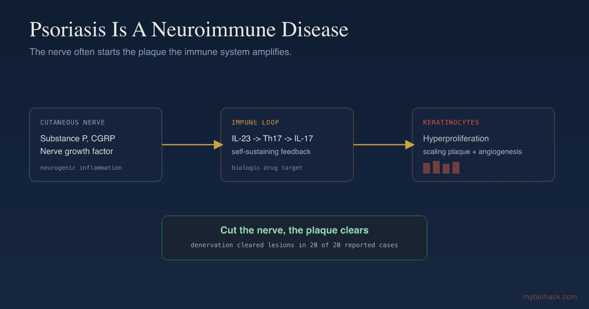 Psoriasis As A Neuroimmune Disease: Neurogenic Inflammation, NGF, And Why Cutting A Nerve Can Clear A Plaque