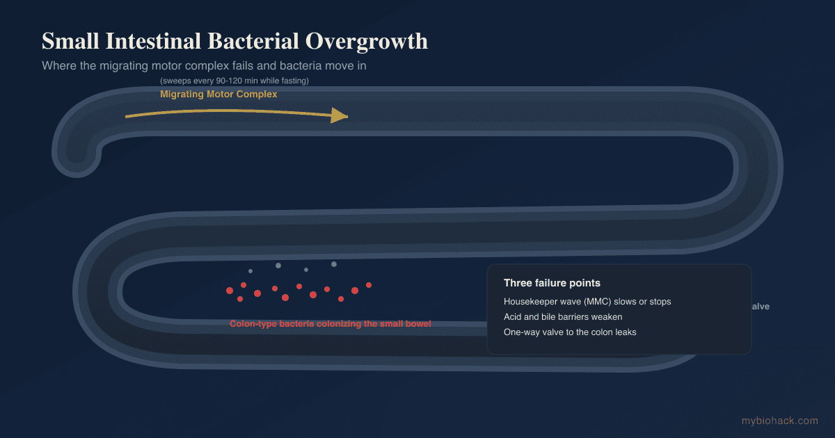 SIBO (Small Intestinal Bacterial Overgrowth): Root Causes, Testing, And Evidence-Based Treatment