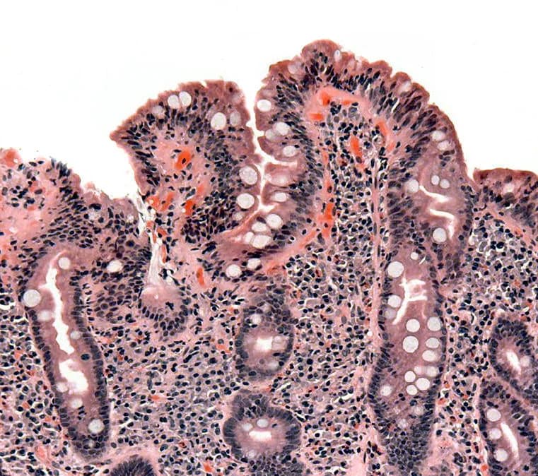 Dysbiosis Basics and Tests